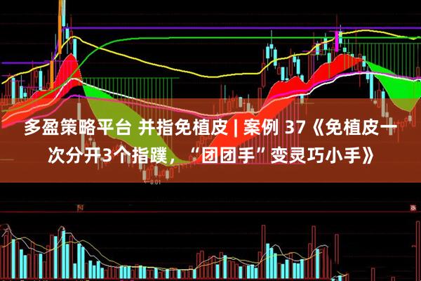 多盈策略平台 并指免植皮 | 案例 37《免植皮一次分开3个指蹼，“团团手”变灵巧小手》